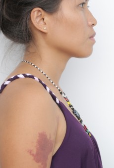 BIRTHMARK in development